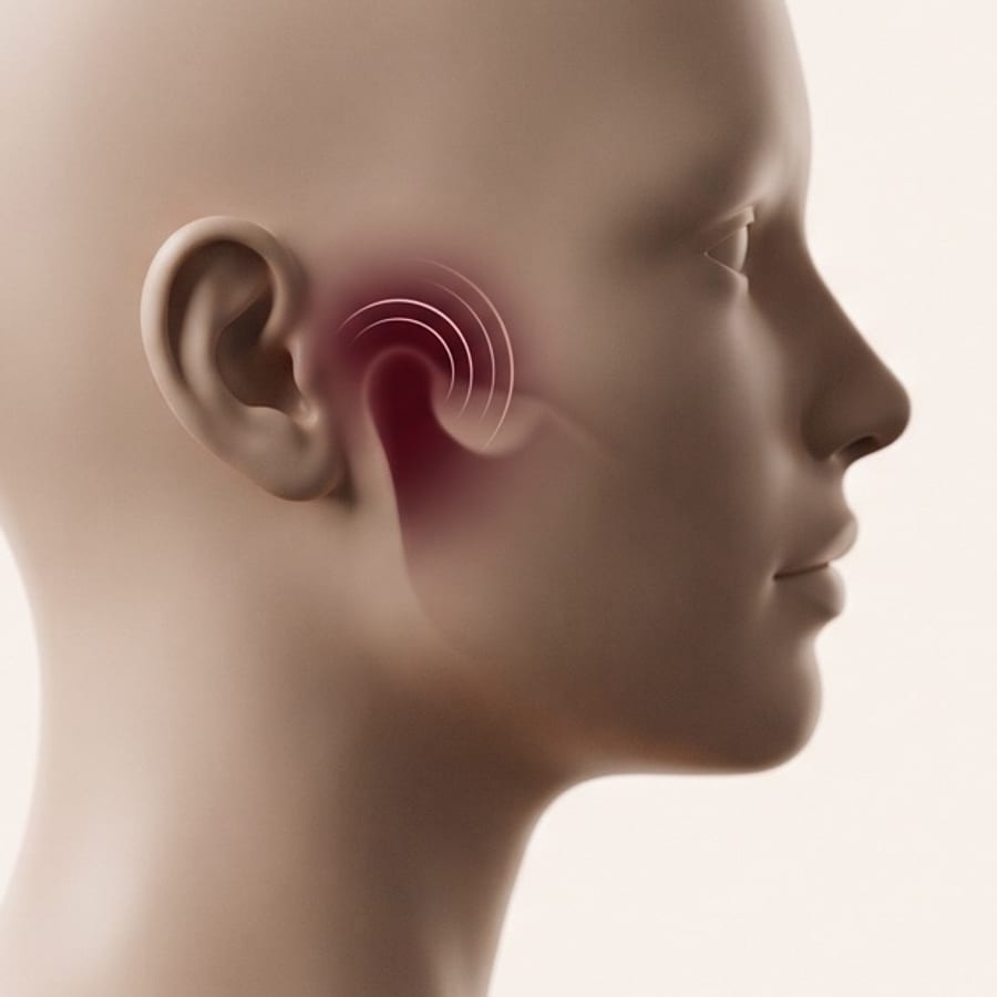 Ilustração anatômica de perfil com as regiões tratadas: articulação temporomandibular, músculos da mastigação, sisos, dentes e mandíbula